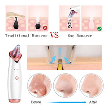 Load image into Gallery viewer, Facial Blackhead Remover Electric Vacuum Machine
